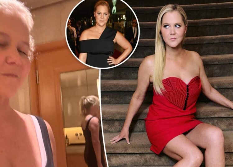 Amy Schumer shows off 50-pound weight loss in Skims selfie
