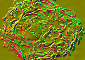 So You Have Bacterial Vaginosis. What Do You Do Now?