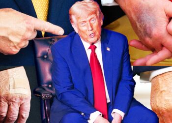 How Trump, 79, Turned Bruises and Cankles into Full-Scale Health Crisis