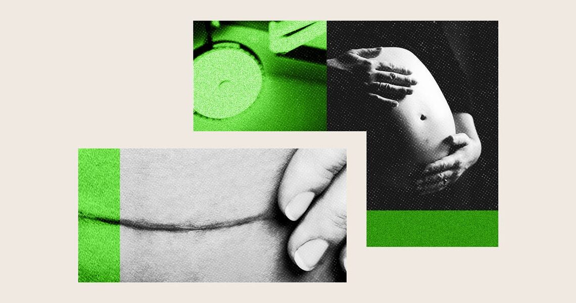 How Business Insider investigated C-sections at over 1,700 American hospitals