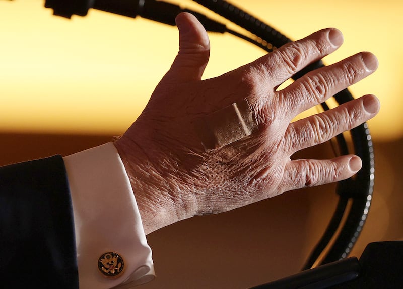 A bandage is visible on U.S. President Donald Trump's right hand as he delivers remarks during an event at Mount Airy Casino Resort on December 9, 2025 in Mount Pocono, Pennsylvania. President Trump is discussing his economic agenda and his efforts to lower the cost of living.