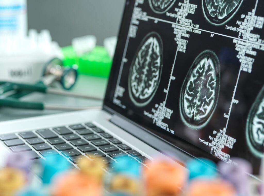 What blood tests to detect Alzheimer’s biomarkers can and can’t tell you