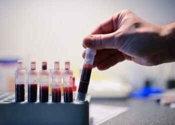 Small study shows a promising path toward HIV cure