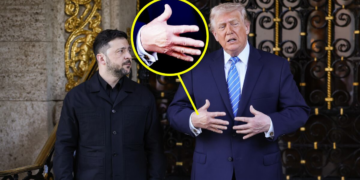 Trump, 79, Slathers on Makeup After Bruising Spotted on Both Hands