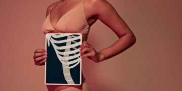 Why Women Are Spending a Fortune to Have Their Ribs Removed