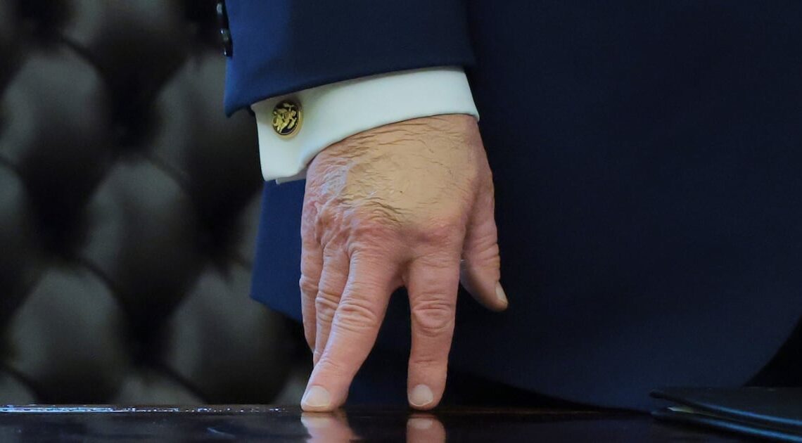 Trump, 79, Cakes Hand in Makeup After Insisting It’s Treason to Discuss His Health Problems