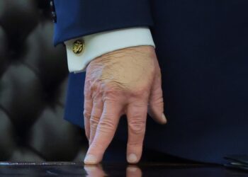 Trump, 79, Cakes Hand in Makeup After Insisting It’s Treason to Discuss His Health Problems