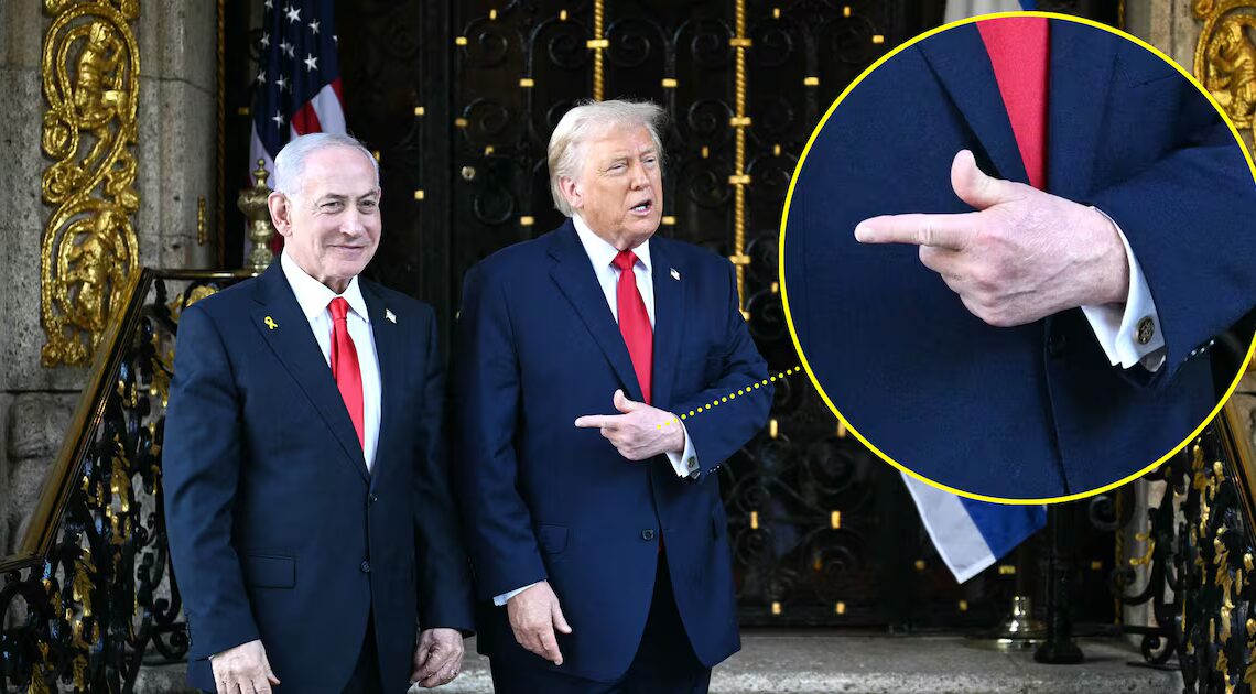 Trump, 79, Doesn’t Even Try to Cover Up Bruising on ‘Good’ Hand