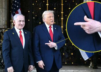 Trump, 79, Doesn’t Even Try to Cover Up Bruising on ‘Good’ Hand