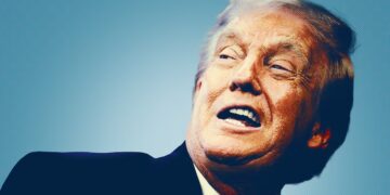 Donald Trump, 79, Returns With Mystery Addition to Bruised Hand