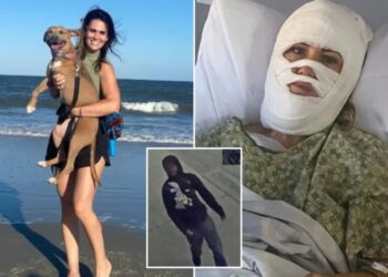 Churchgoing Georgia woman, 46 suffered severe burns in random toxic chemical attack while walking at park