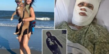 Churchgoing Georgia woman, 46 suffered severe burns in random toxic chemical attack while walking at park