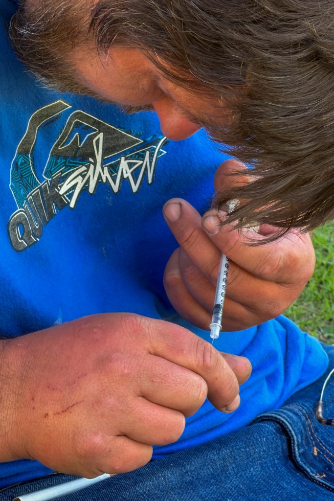 Close-up of a person holding a syringe with a needle, possibly preparing to inject, with traces of wear and tear on their skin.