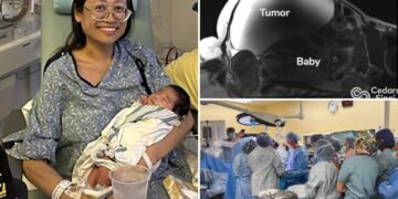 Doctors deliver ‘miracle’ baby while removing 22-pound tumor from mother