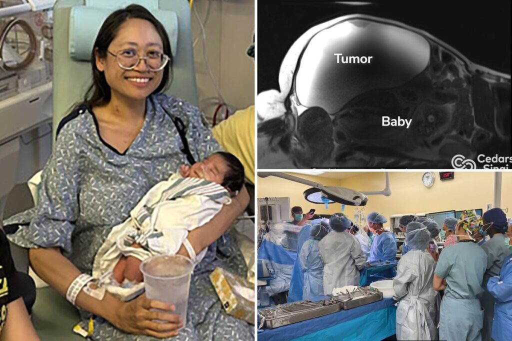 Doctors deliver ‘miracle’ baby while removing 22-pound tumor from mother