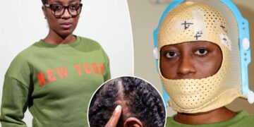 I developed a brain tumor the size of a lime at 30 — now I’m one of over 1,700 women suing my birth control company