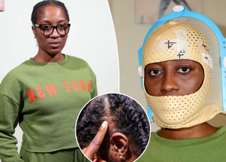 I developed a brain tumor the size of a lime at 30 — now I’m one of over 1,700 women suing my birth control company