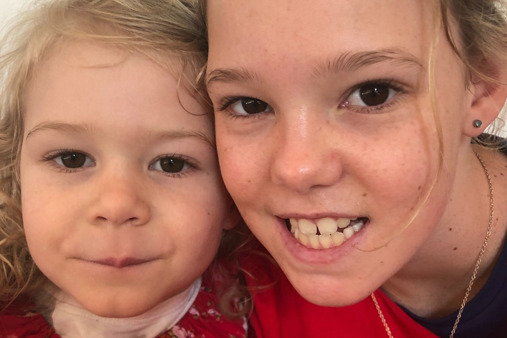 Close-up of Amielle, 12, and Taya, 7, two sisters who live with Xeroderman Pigmentosum (XP).