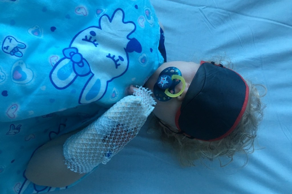 Taya, age 7, wearing a sleep mask and a pacifier, with her arm bandaged.