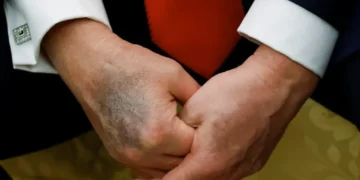 DC insiders whisper about ‘Trump’s decay’ as Dems plot to turn him into ‘lamest of ducks’