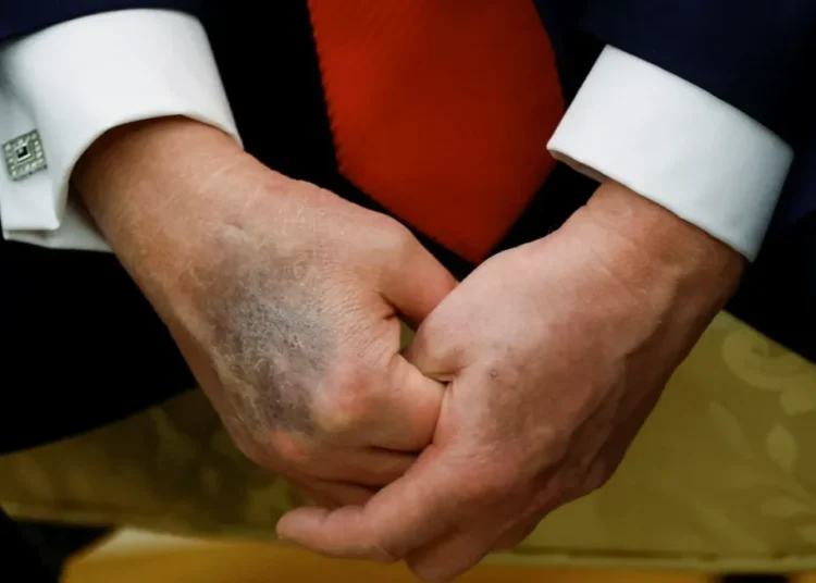 DC insiders whisper about ‘Trump’s decay’ as Dems plot to turn him into ‘lamest of ducks’