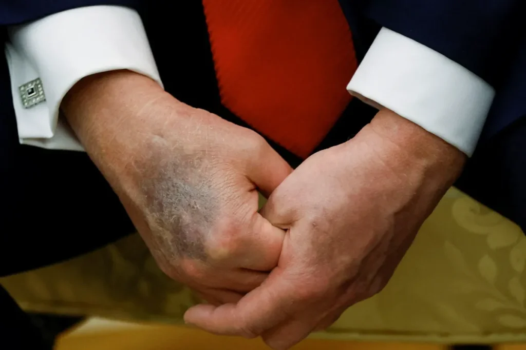 DC insiders whisper about ‘Trump’s decay’ as Dems plot to turn him into ‘lamest of ducks’