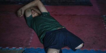 Gaza amputees struggle to rebuild lives as the enclave faces shortages of prosthetic limbs