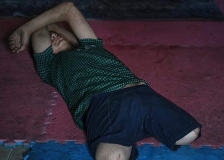 Gaza amputees struggle to rebuild lives as the enclave faces shortages of prosthetic limbs