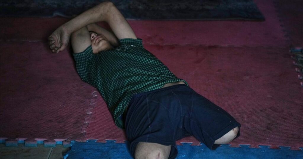Gaza amputees struggle to rebuild lives as the enclave faces shortages of prosthetic limbs