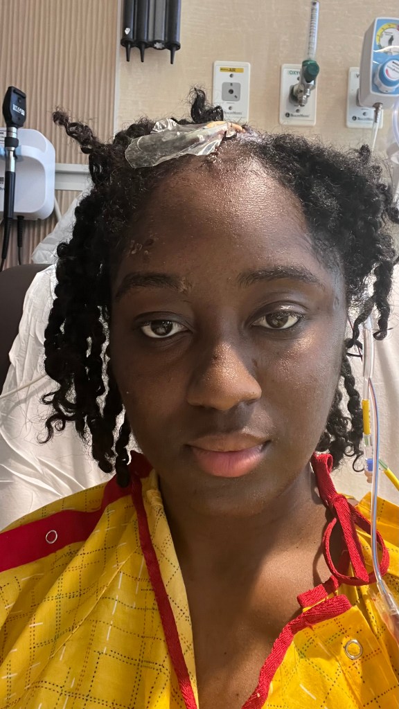 Elizabeth Fleurisma in a hospital bed with medical sensors on her head.