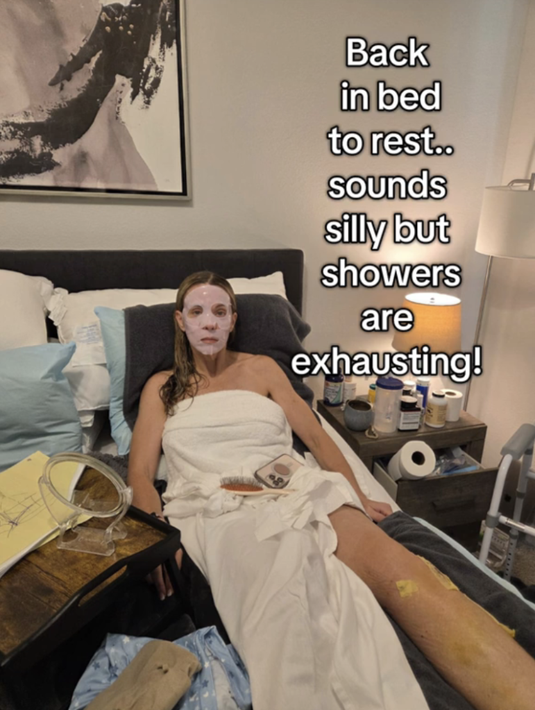 Kate Gosselin in bed after a shower, with a face mask, and a bandaged leg, with text 