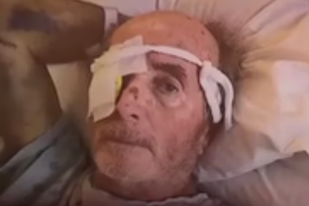 Curtis Lind, 82, after the attack in Vallejo, CA. He was later murdered before he could testify agaist Dao and Leatham.