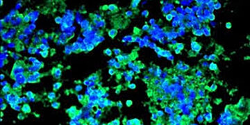 Some Immune Systems Defeat Cancer. Could That Become a Drug?