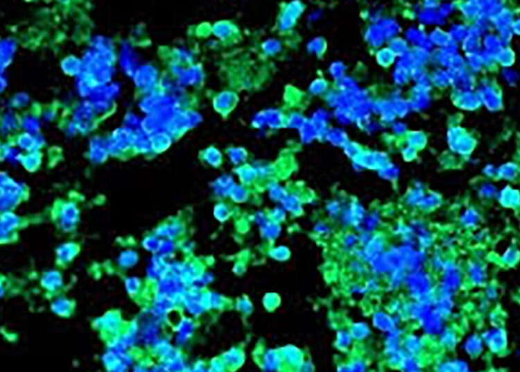 Some Immune Systems Defeat Cancer. Could That Become a Drug?