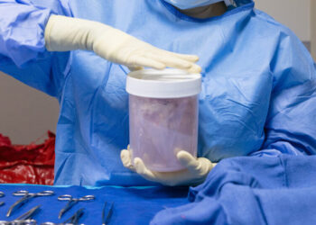 Increased Scrutiny Leads to an Improved Organ Transplant System