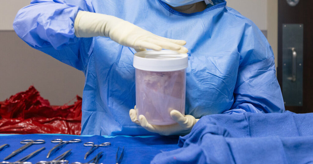 Increased Scrutiny Leads to an Improved Organ Transplant System