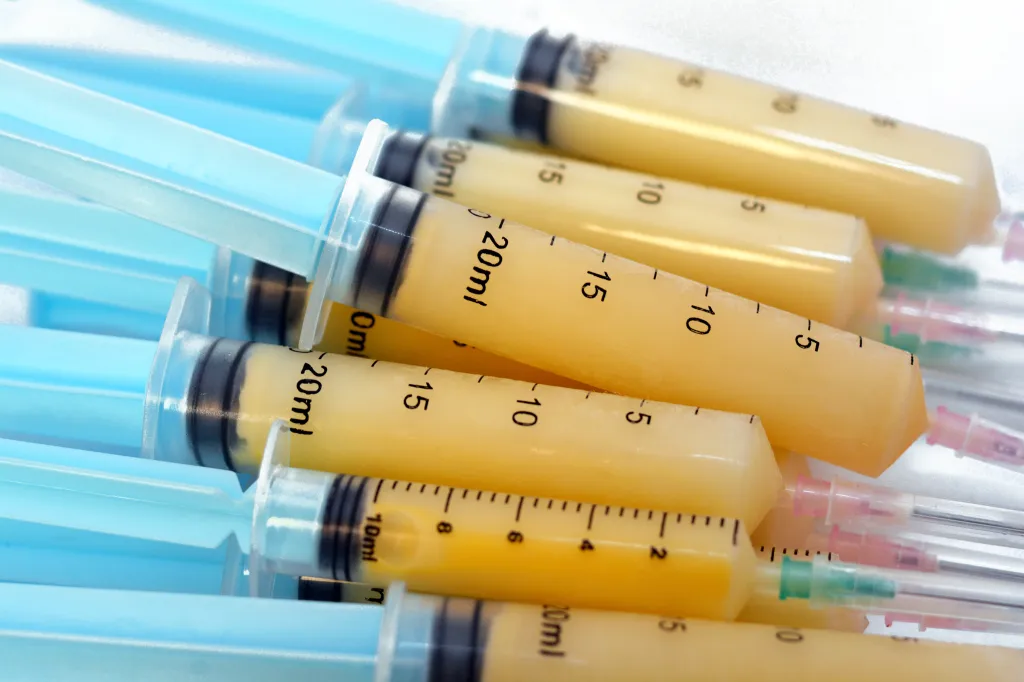 Syringes containing colostrum for infant feeding.