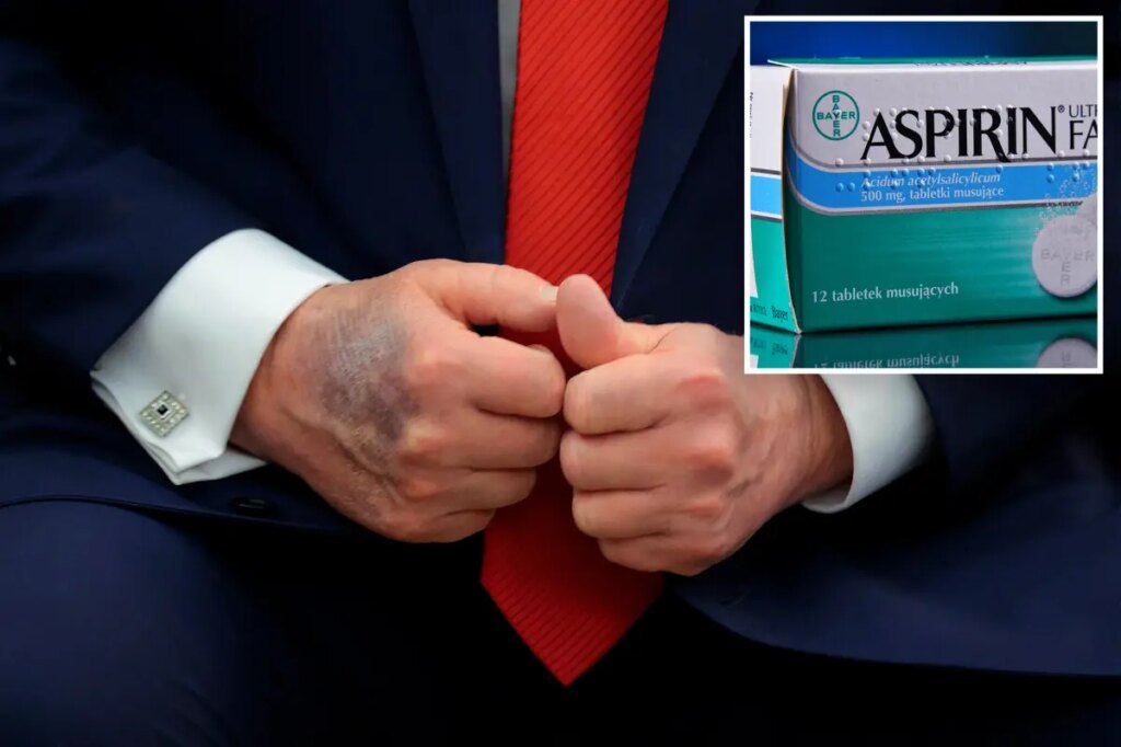 What happens if you take too much aspirin? Trump says ‘higher dose’ is responsible for hand bruising