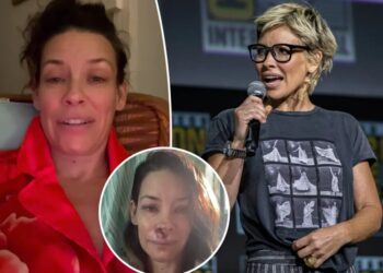 Evangeline Lilly shares devastating brain injury months after falling face-first on boulder