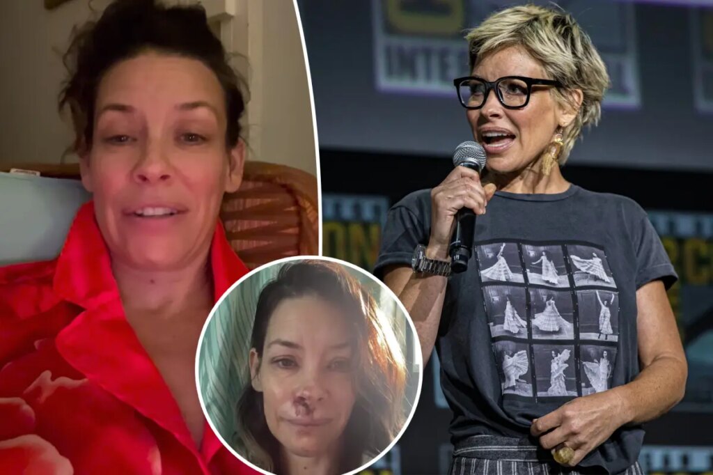 Evangeline Lilly shares devastating brain injury months after falling face-first on boulder