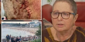 Bondi Beach victim outraged after her name was changed by hospital during treatment: ‘Ripped of my identity’