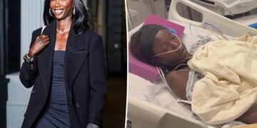 Supermodel Anok Yai, 28, undergoes ‘life-saving procedure’ due to sepsis following lung surgery