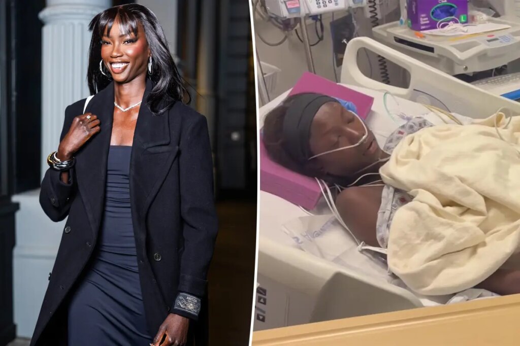 Supermodel Anok Yai, 28, undergoes ‘life-saving procedure’ due to sepsis following lung surgery
