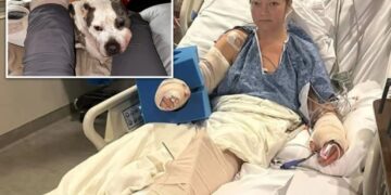Tennessee mom loses leg in attack by her own pit bull that left limb ‘basically hanging off’
