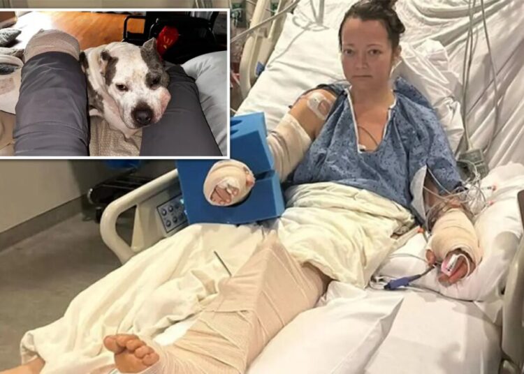 Tennessee mom loses leg in attack by her own pit bull that left limb ‘basically hanging off’