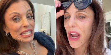 Bethenny Frankel says this common item is to blame for her facial bacterial infection