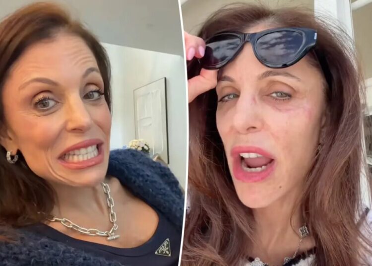 Bethenny Frankel says this common item is to blame for her facial bacterial infection