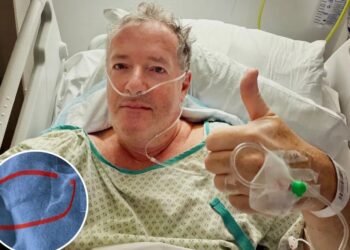 Piers Morgan, 60, hospitalized, will undergo hip replacement after fracturing thigh bone in fall