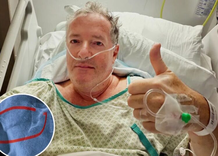 Piers Morgan, 60, hospitalized, will undergo hip replacement after fracturing thigh bone in fall