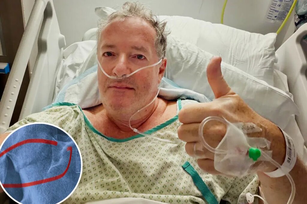 Piers Morgan, 60, hospitalized, will undergo hip replacement after fracturing thigh bone in fall
